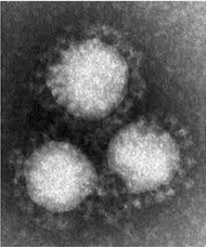 コロナウイルス 歴史に残る